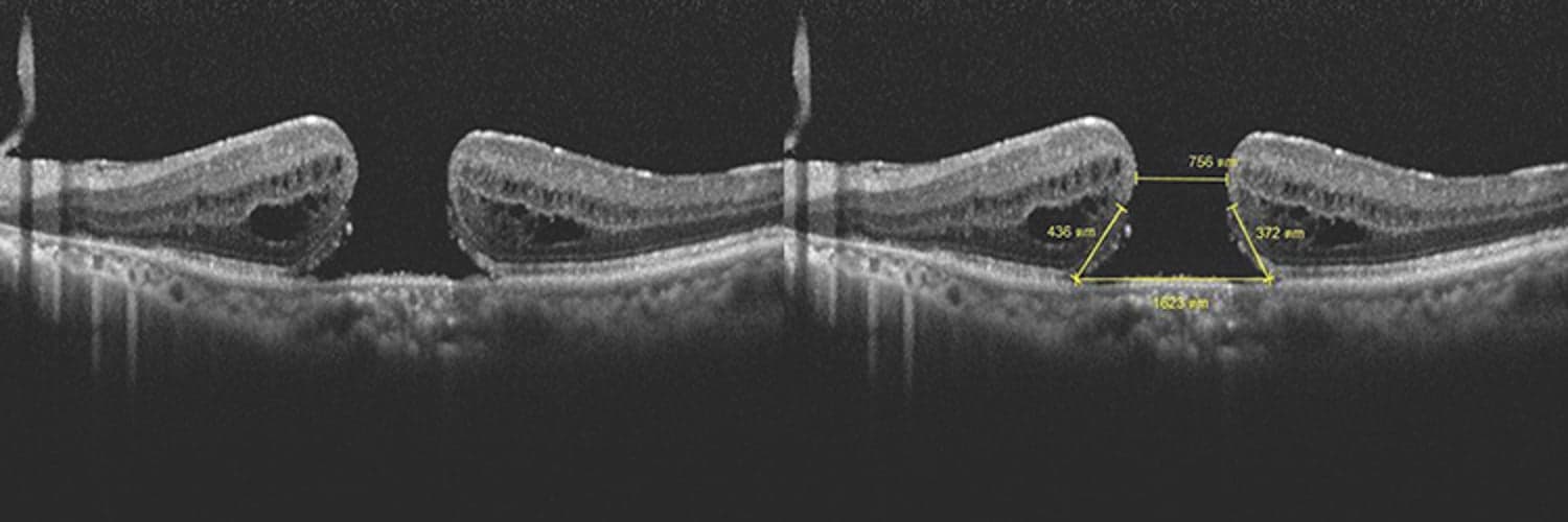 Survey - OCT Anomaly Detection Methodology – Seeking Experts in Singapore image