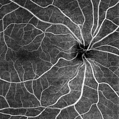 Survey - OCT Anomaly Detection Methodology – Seeking Experts in Singapore image